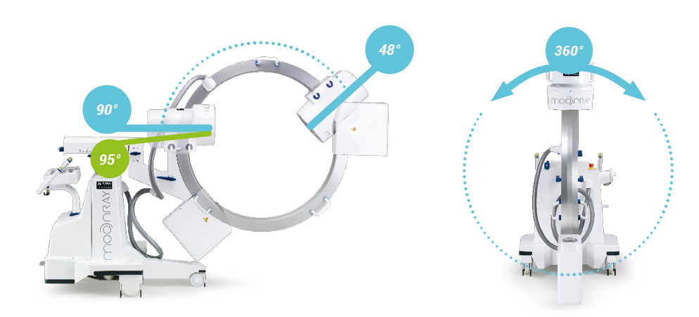 Simad - Mobile C- arm Moonray Dual Radiology Device